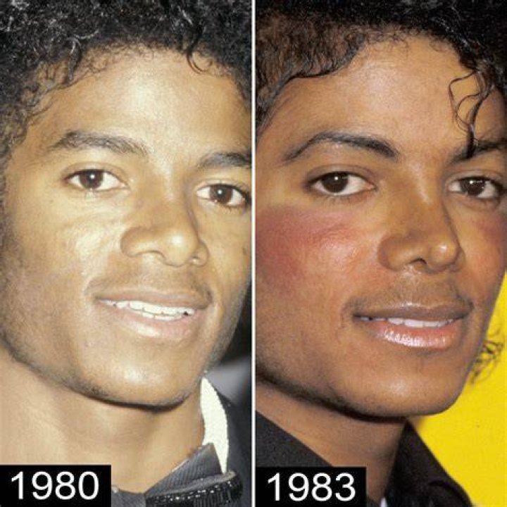 Did Randy Jackson Undergo Plastic Surgery?
