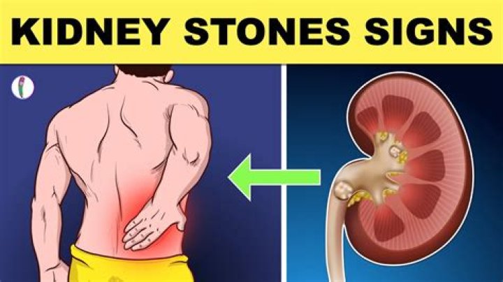 Kidney Rock